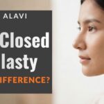 Open vs Closed Rhinoplasty in Lahore - Dr. Hirra Alavi